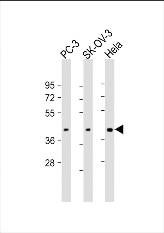 Rabbit Polyclonal Antibody to ST3GAL4 (N-Term)