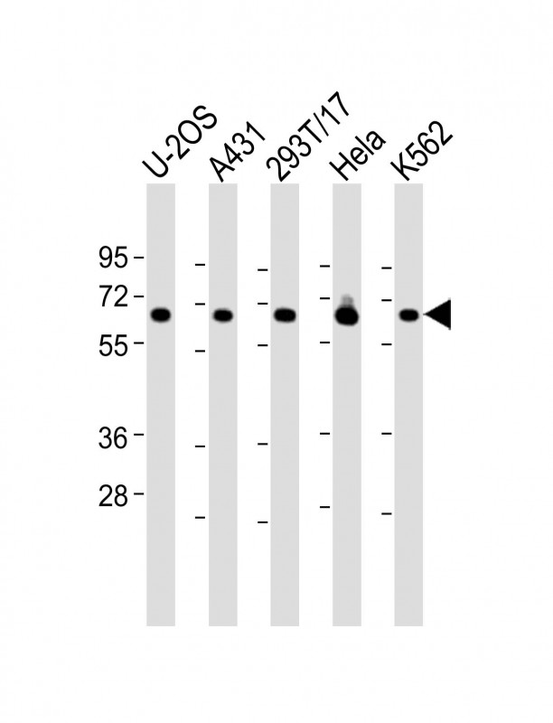 Rabbit Polyclonal Antibody to RSL1D1