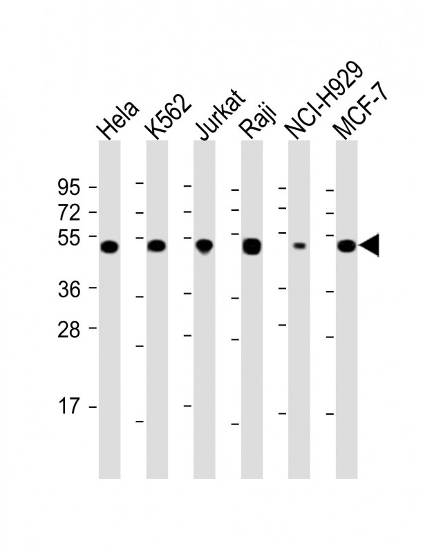 Rabbit Polyclonal Antibody to RPL4 (N-Term)