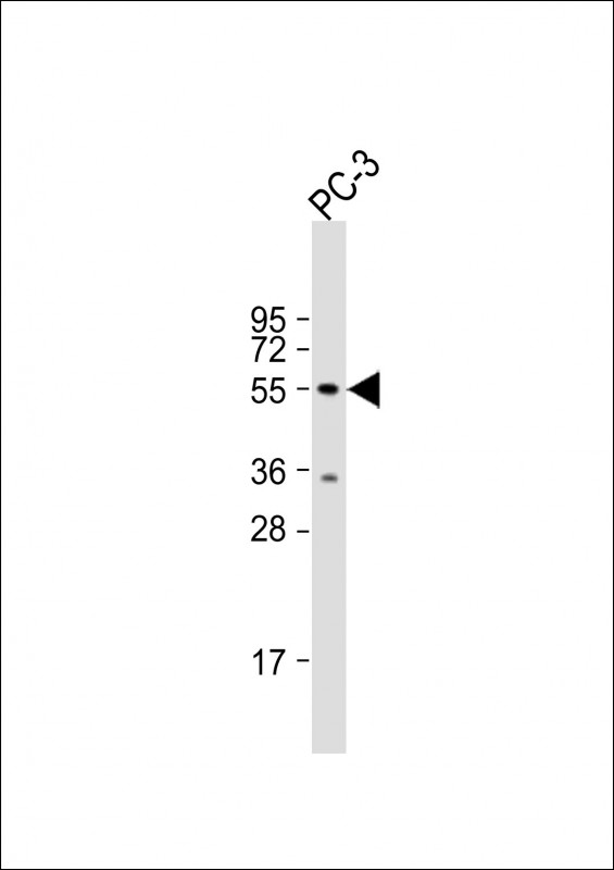 Rabbit Polyclonal Antibody to RNF36 (TRIM69) (Center H215)