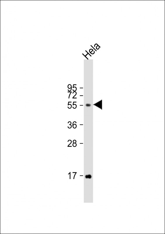 Rabbit Polyclonal Antibody to FUT6