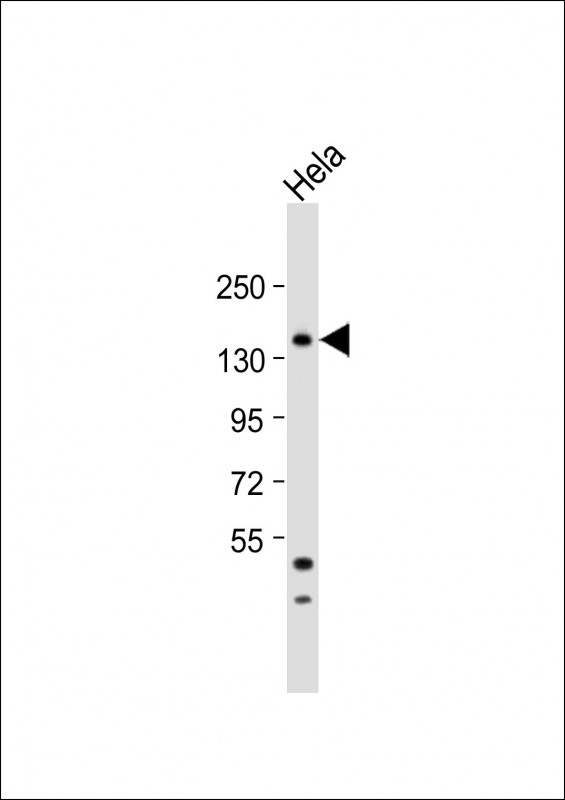 Rabbit Polyclonal Antibody to MTMR15  (N-term)