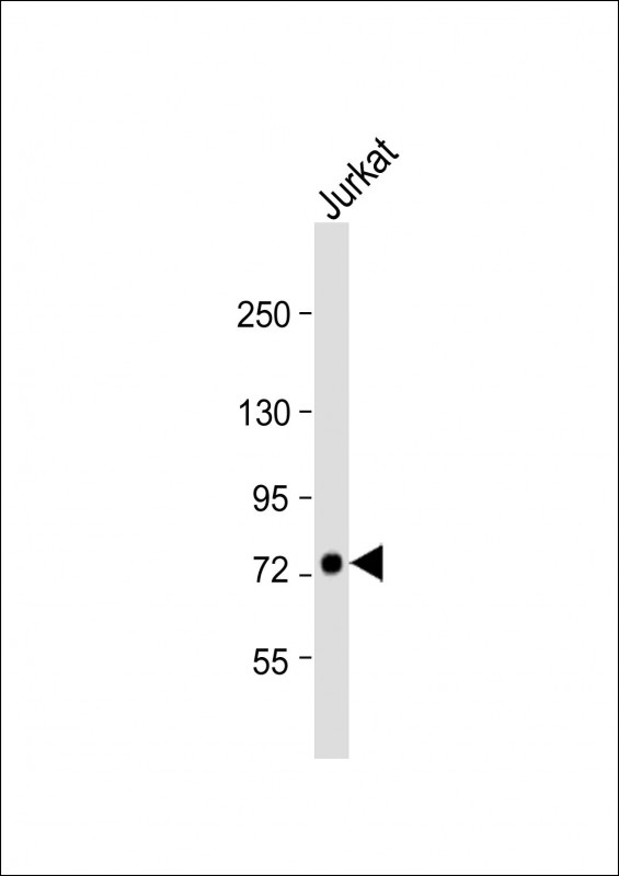 Rabbit Polyclonal Antibody to GGNBP2