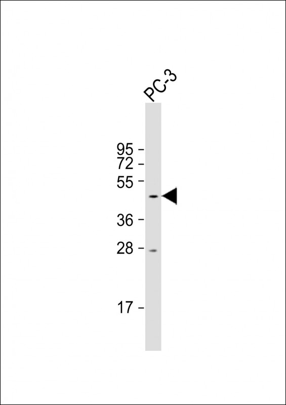 Rabbit Polyclonal Antibody to C3orf31
