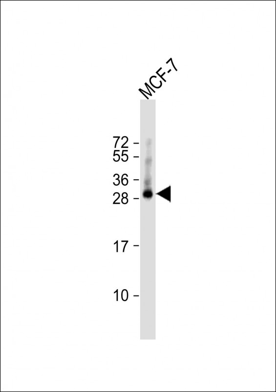 Rabbit Polyclonal Antibody to TMEM111  (N-term)