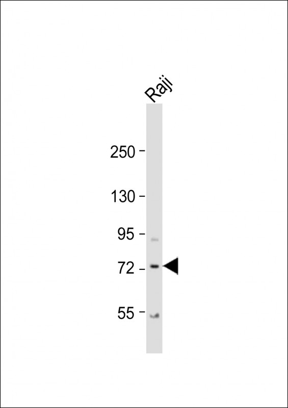Rabbit Polyclonal Antibody to KLHL6  (C-term)
