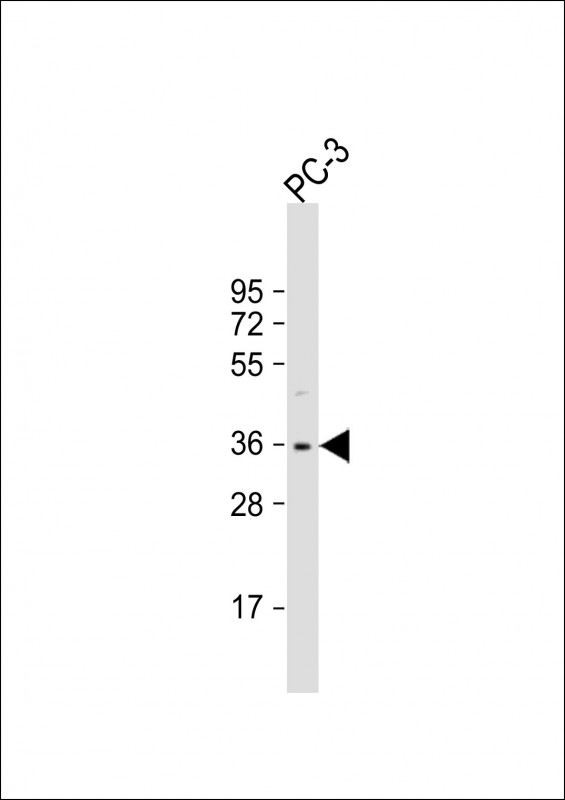 Rabbit Polyclonal Antibody to OTUD6B