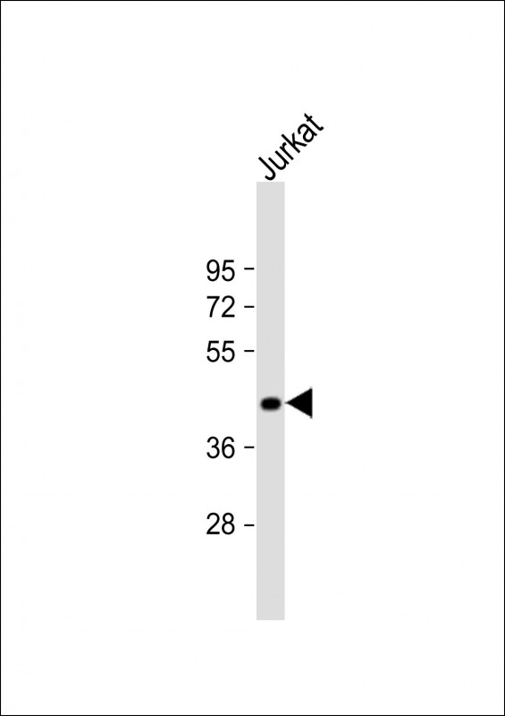 Rabbit Polyclonal Antibody to ST3GAL5