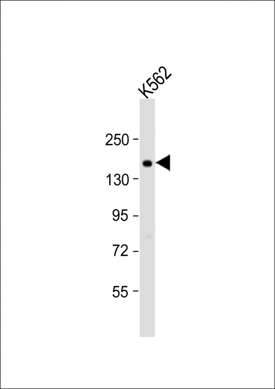 Rabbit Polyclonal Antibody to ADCY10