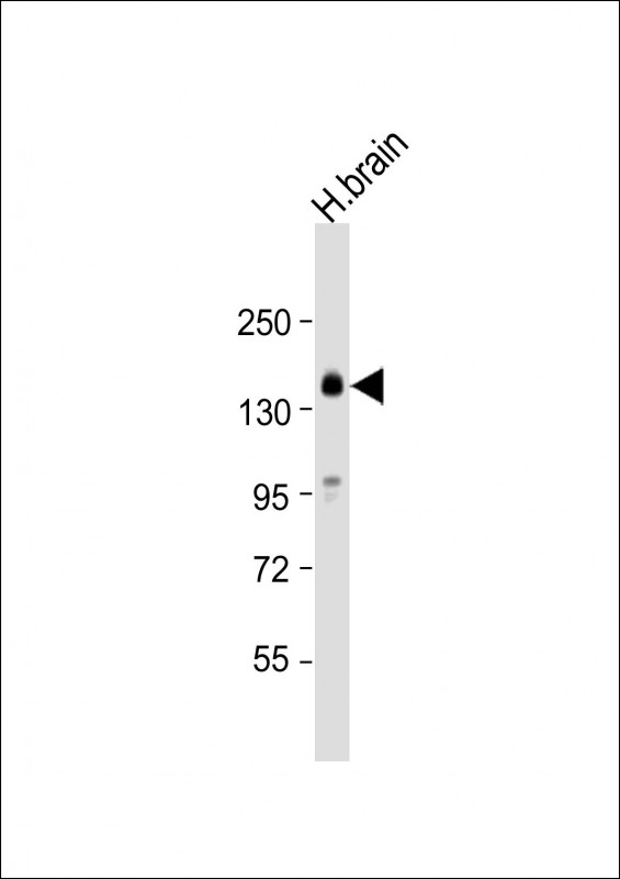 Rabbit Polyclonal Antibody to SLC12A5 (N-term)