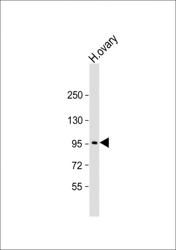 Rabbit Polyclonal Antibody to LRP3