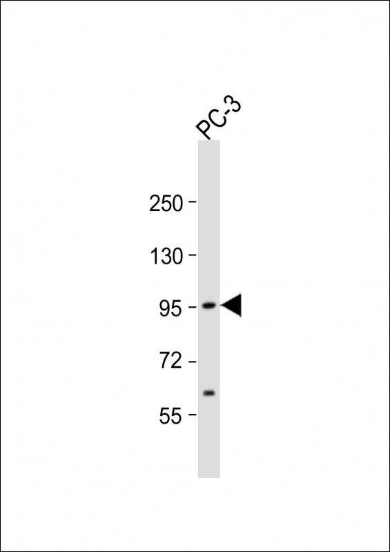 Rabbit Polyclonal Antibody to ST14
