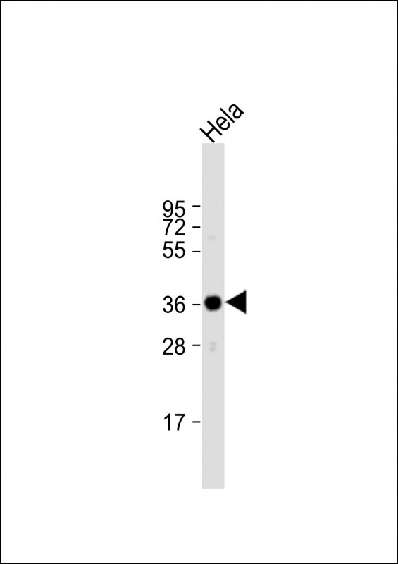 Rabbit Polyclonal Antibody to ARPC1A
