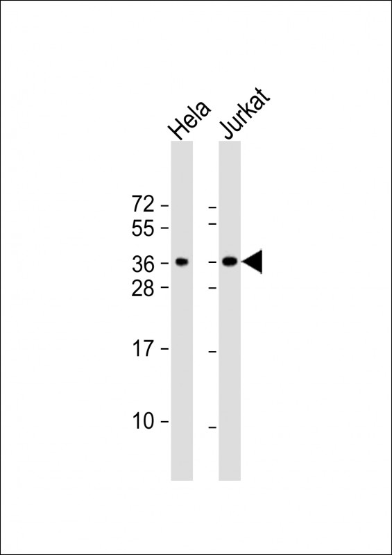 Rabbit Polyclonal Antibody to CLNS1A