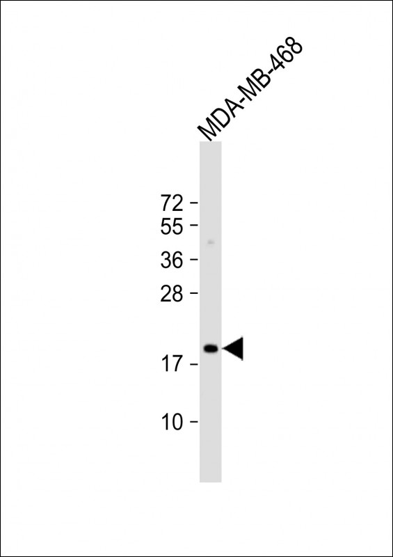 Rabbit Polyclonal Antibody to MAFF