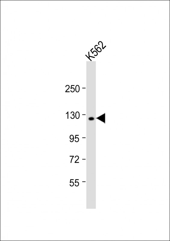 Rabbit Polyclonal Antibody to LARS
