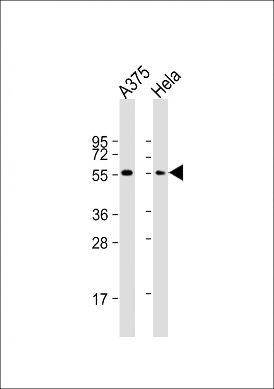 Rabbit Polyclonal Antibody to PTRF (N-term)