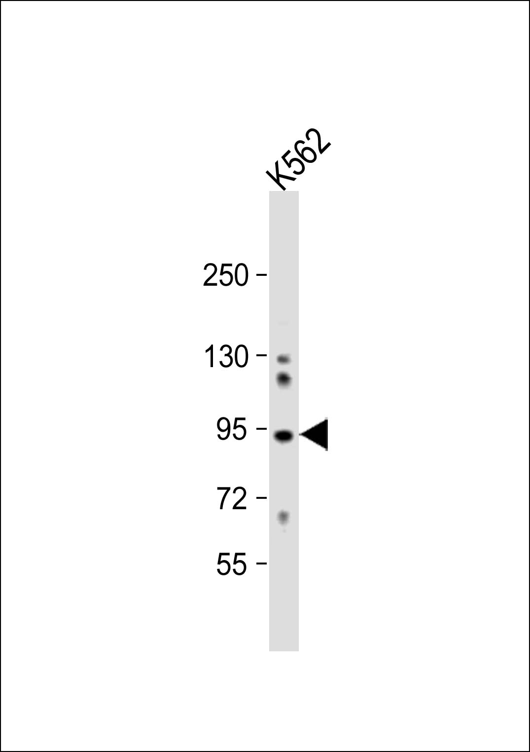 Rabbit Polyclonal Antibody to COG4