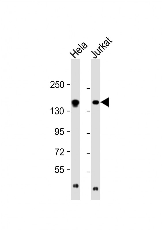 Rabbit Polyclonal Antibody to EPRS (N-term)