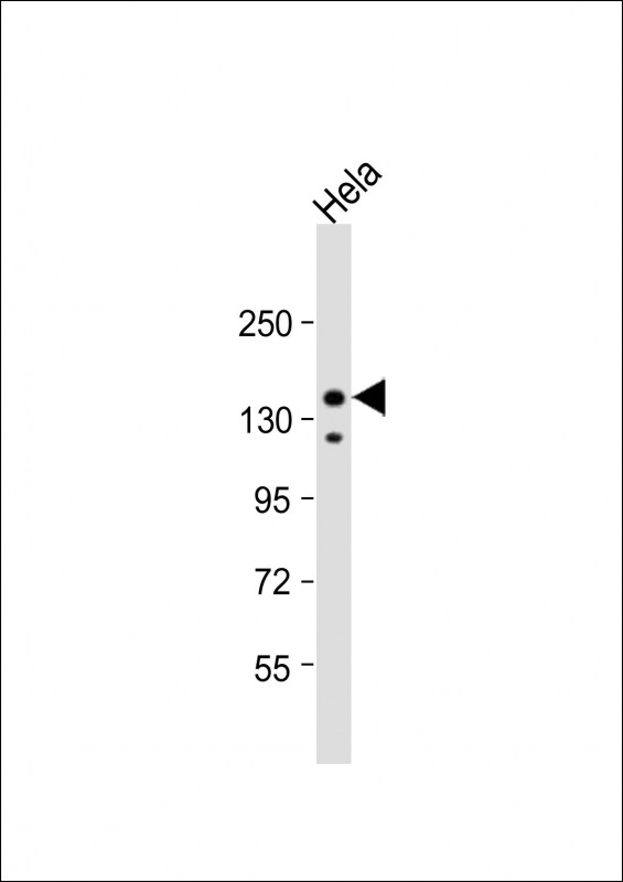Rabbit Polyclonal Antibody to IRS2