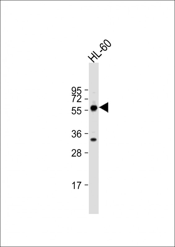 Rabbit Polyclonal Antibody to TESK2 (Center C225)
