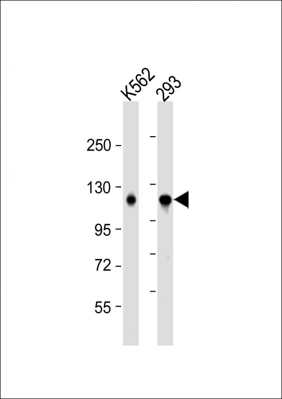 Rabbit Polyclonal Antibody to IARS2