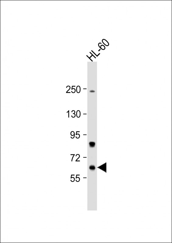 Rabbit Polyclonal Antibody to Methionyl tRNA Synthetase