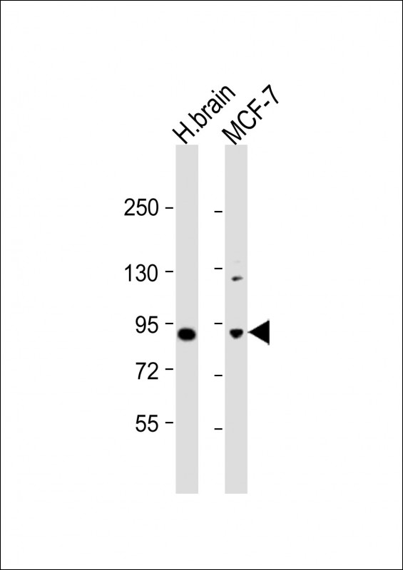 Rabbit Polyclonal Antibody to JIP1