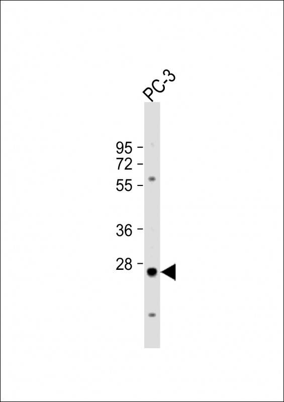 Rabbit Polyclonal Antibody to CREM