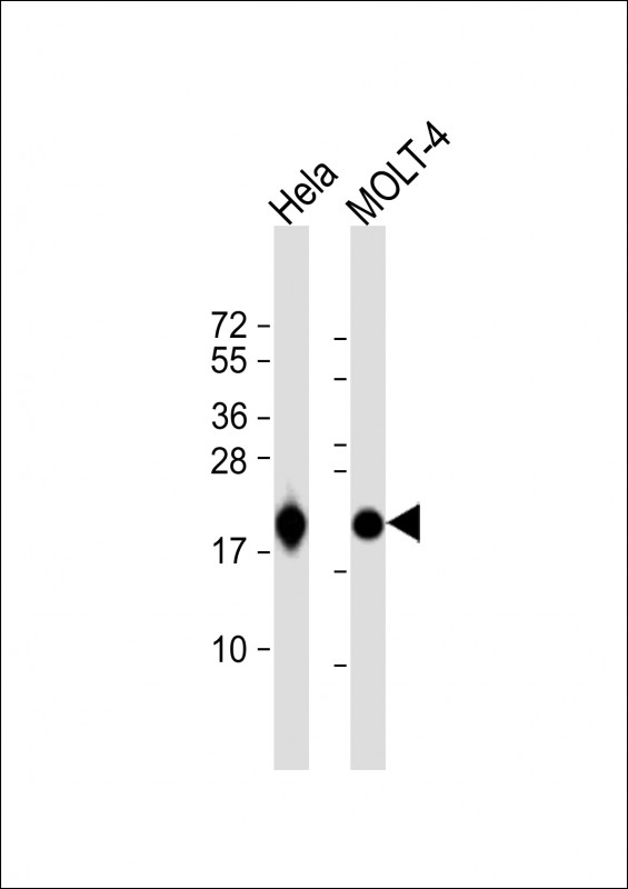 Rabbit Polyclonal Antibody to RPL18A