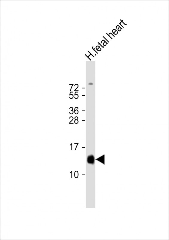 Rabbit Polyclonal Antibody to HBA2