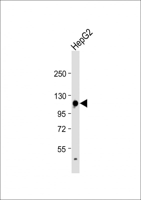Rabbit Polyclonal Antibody to GLDC (N-term)