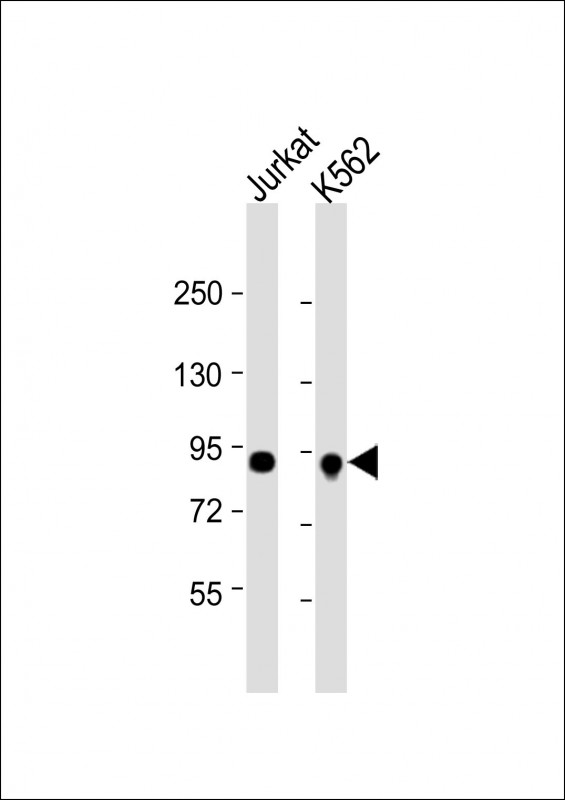 Rabbit Polyclonal Antibody to SPN