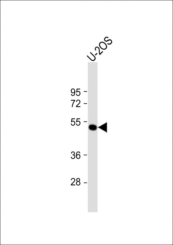 Rabbit Polyclonal Antibody to ANKH