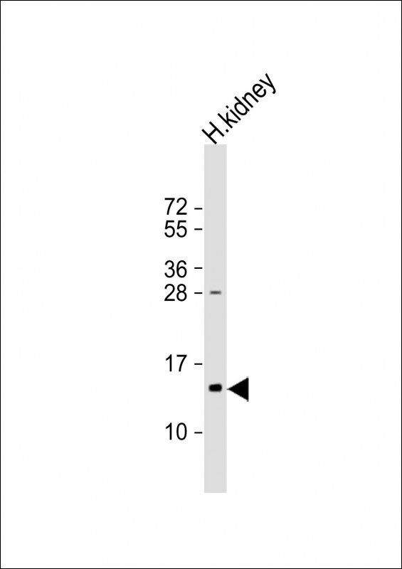 Rabbit Polyclonal Antibody to TMIE