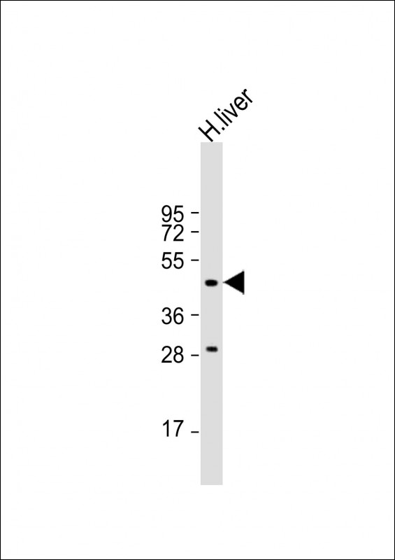 Rabbit Polyclonal Antibody to MMAA (N-term)