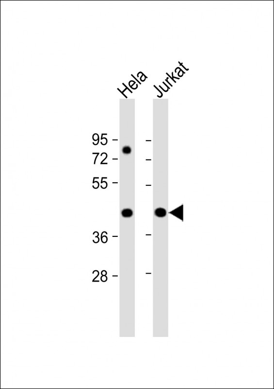 Rabbit Polyclonal Antibody to PR38A  (C-term)