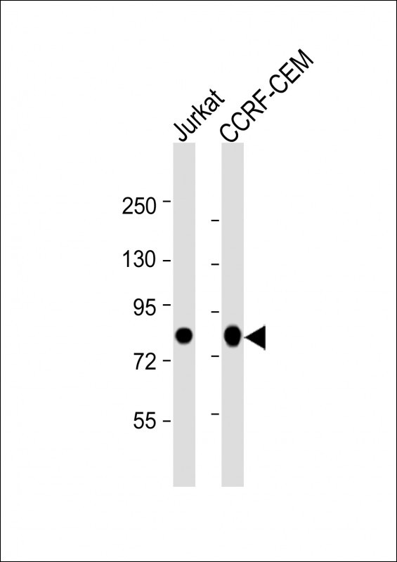 Mouse Monoclonal Antibody to MYB