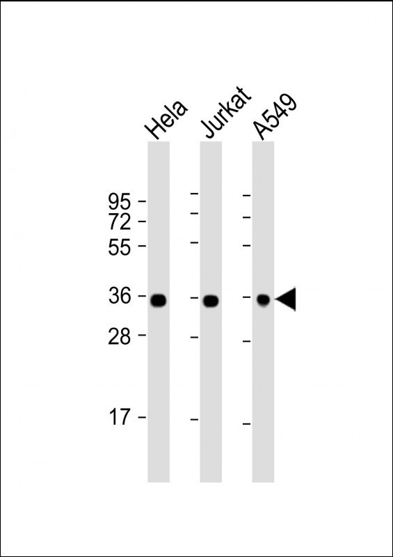 Mouse Monoclonal Antibody to GAPDH