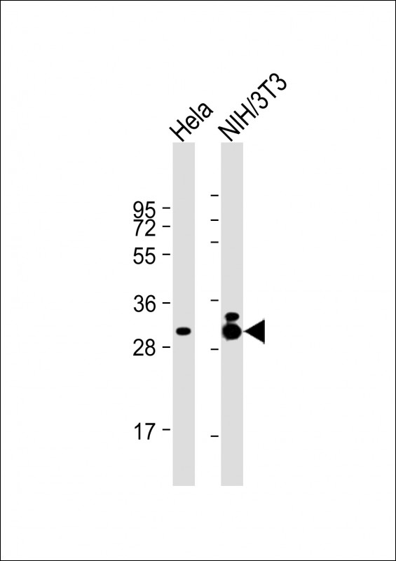 Mouse Monoclonal Antibody to TPM3