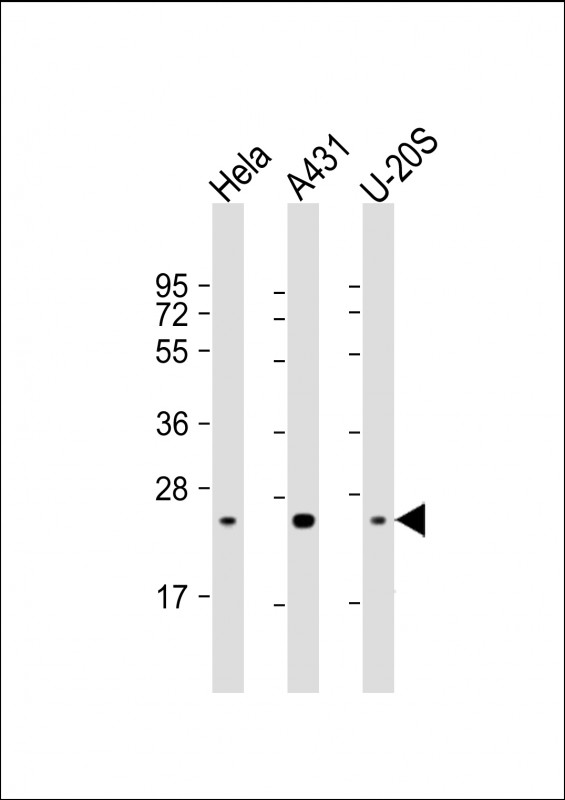 Mouse Monoclonal Antibody to RAB1B