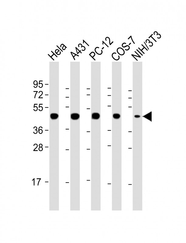 Mouse Monoclonal Antibody to MP2K1