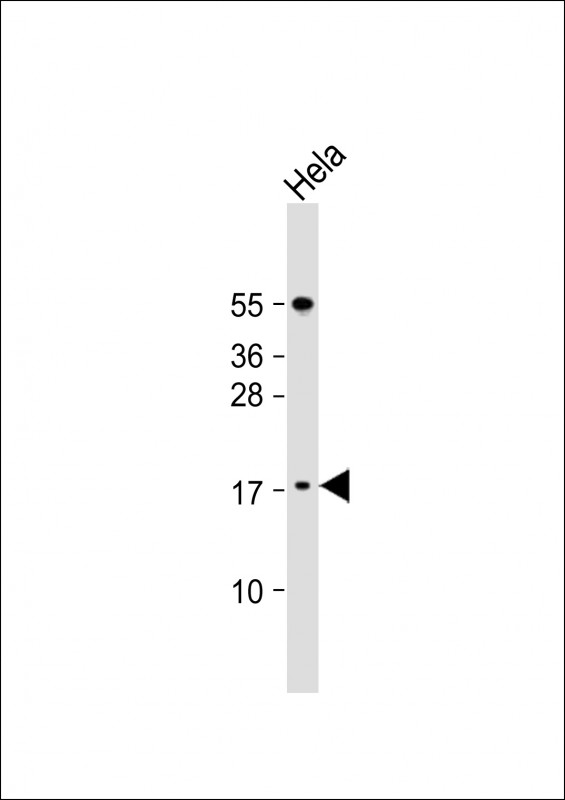 Rabbit Polyclonal Antibody to LSM7