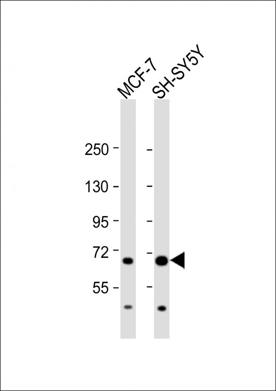 Rabbit Polyclonal Antibody to FOXO3 (N-term)