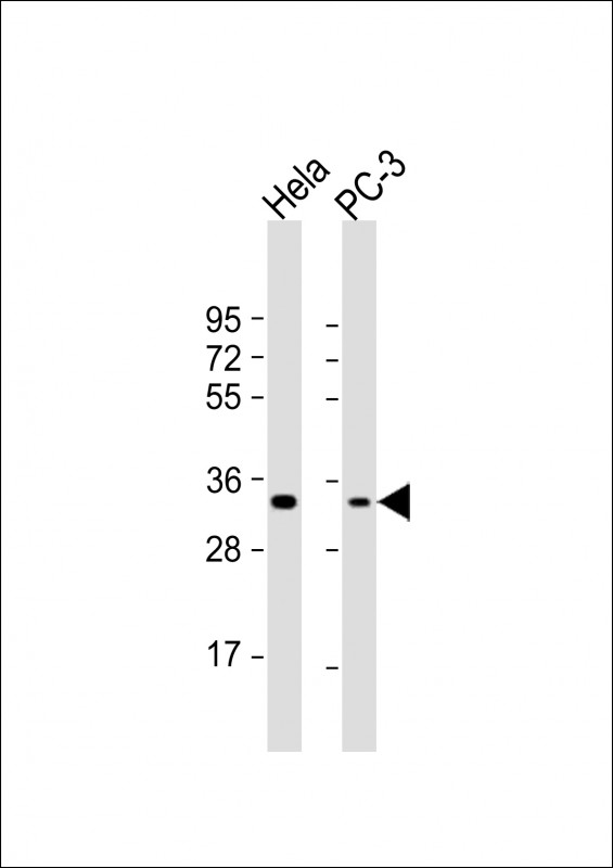 Rabbit Polyclonal Antibody to PI15 (N-term)