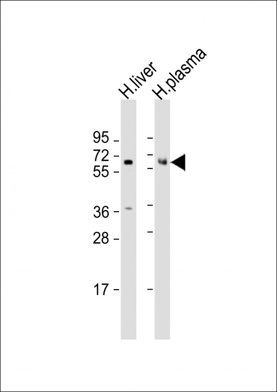 Rabbit Polyclonal Antibody to PROC