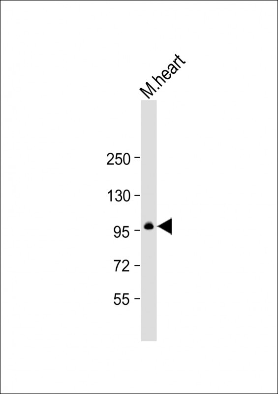 Rabbit Polyclonal Antibody to Mouse Mylk3 (N-term)