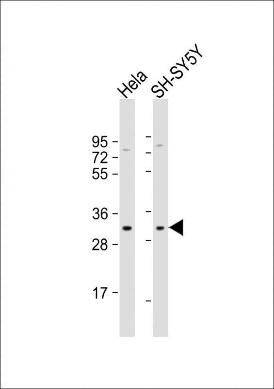 Rabbit Polyclonal Antibody to Connexin 31