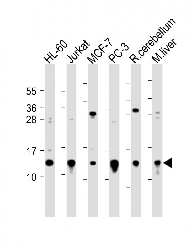 Rabbit Polyclonal Antibody to FAU