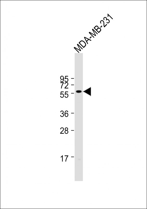 Rabbit Polyclonal Antibody to ONECUT3